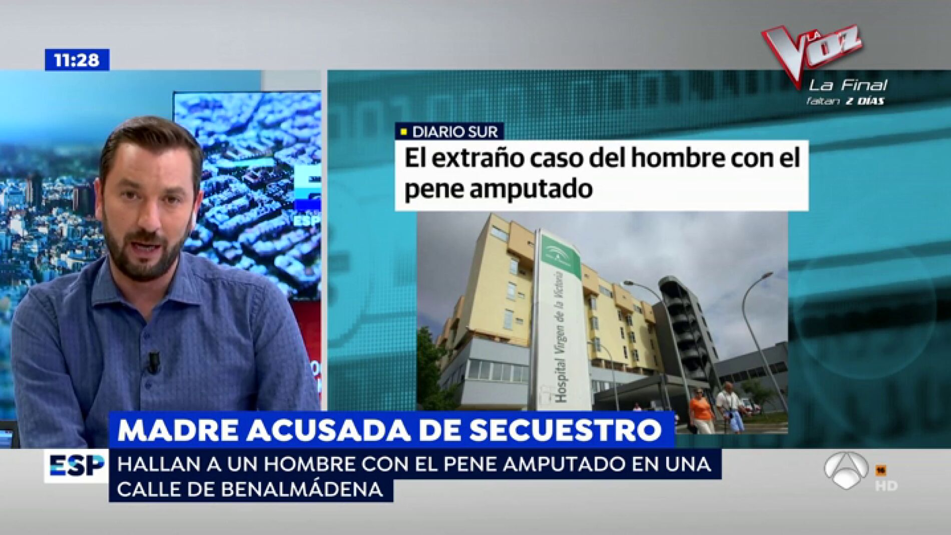 El extra&ntilde;o caso del hombre con el pene amputado
