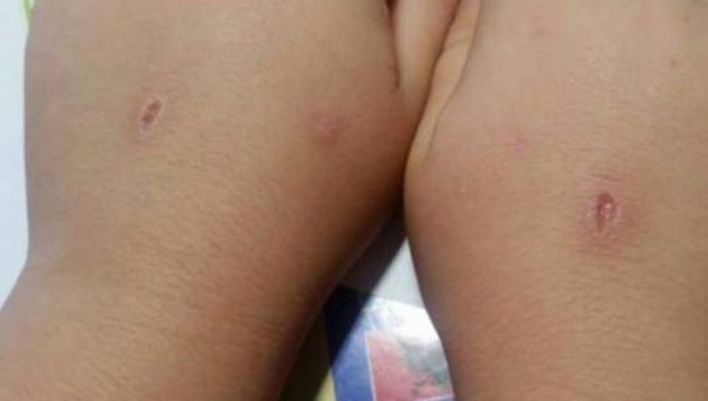 Las manos de un niño que ha jugado al 'abecedario del diablo'