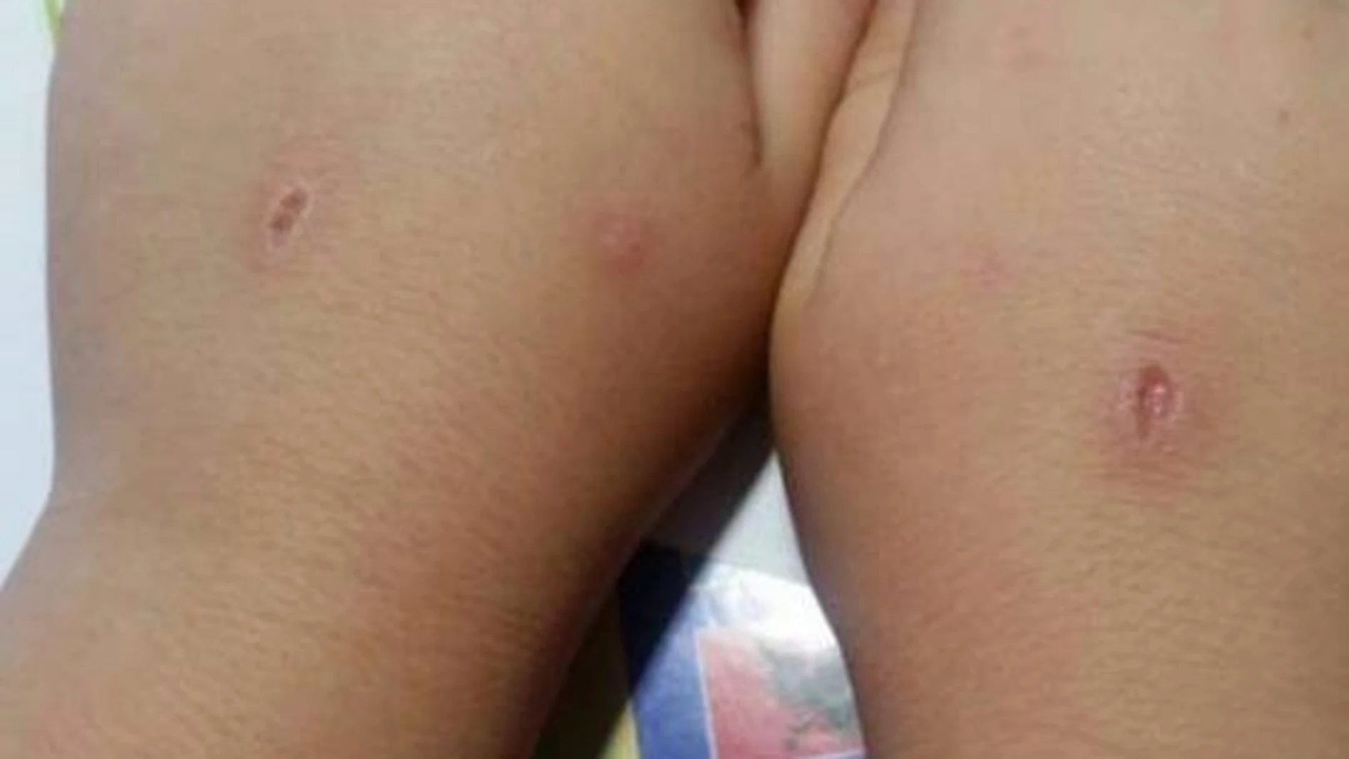 Las manos de un niño que ha jugado al 'abecedario del diablo' Las manos de un niño que ha jugado al 'abecedario del diablo'