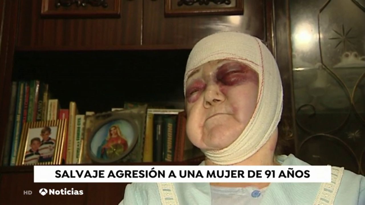Brutal agresión a una mujer de 91 años en Barcelona