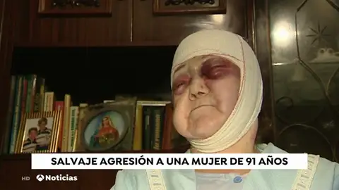 Brutal agresión a una mujer de 91 años en Barcelona Brutal agresión a una mujer de 91 años en Barcelona