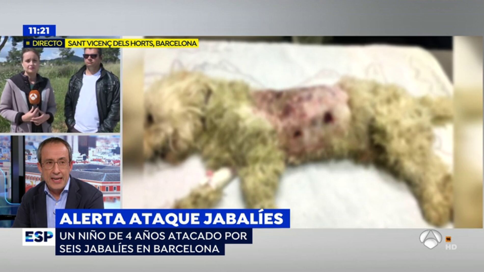 Brutal ataque de jabal&iacute;es a un ni&ntilde;o y su mascota
