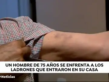Un hombre de 75 años se enfrenta a los ladrones que entran en su casa Un hombre de 75 años se enfrenta a los ladrones que entran en su casa