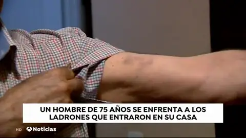 Un hombre de 75 años se enfrenta a los ladrones que entran en su casa Un hombre de 75 años se enfrenta a los ladrones que entran en su casa