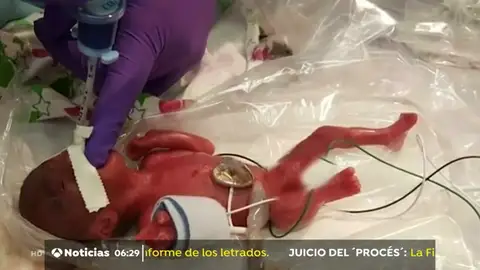 El bebé más pequeño del mundo. Daisy