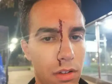 El periodista Xavier Martínez tras sufrir una agresión homófoba El periodista Xavier Martínez tras sufrir una agresión homófoba
