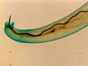 Angiostrongylus cantonensis
