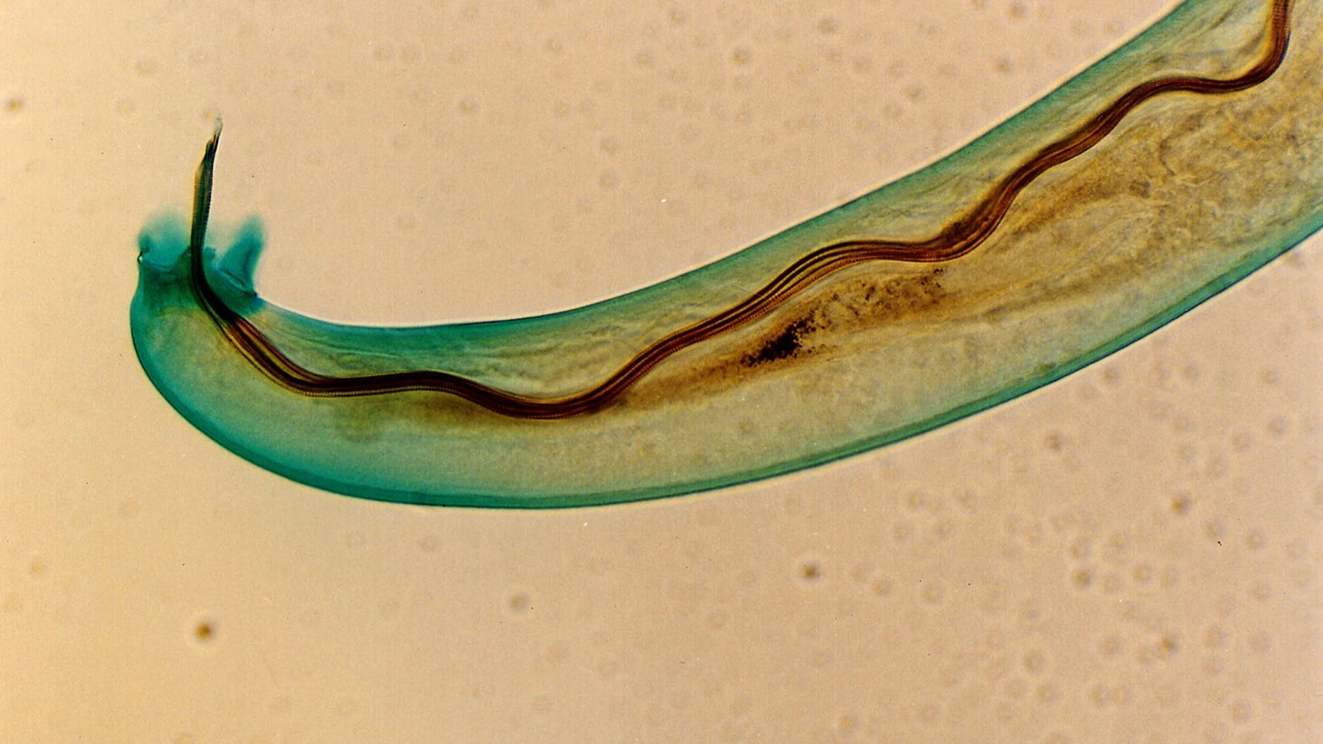 Angiostrongylus cantonensis Angiostrongylus cantonensis
