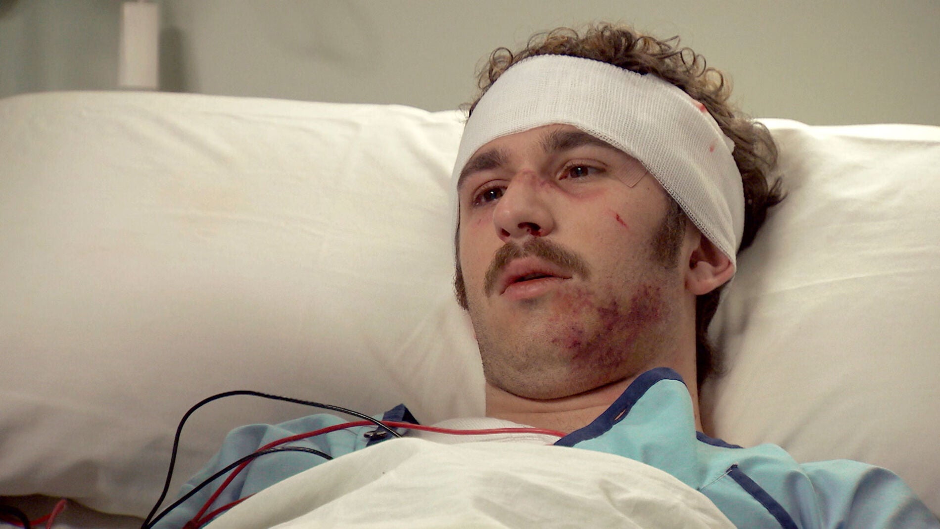 Miguel, v&iacute;ctima de una brutal paliza