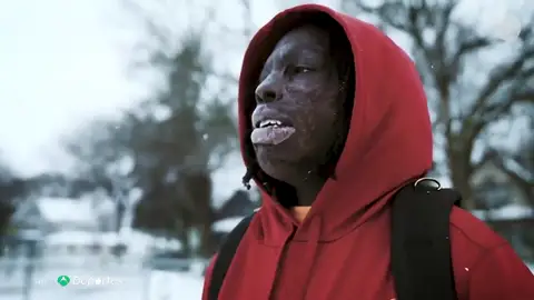 Taquarius Wair, el niño con el cuerpo quemado que sueña con la NFL Taquarius Wair, el niño con el cuerpo quemado que sueña con la NFL