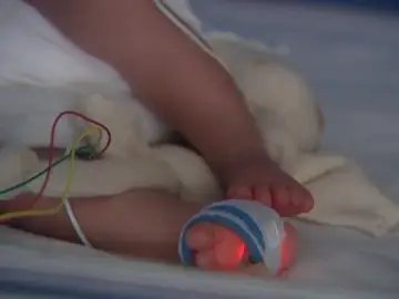 Negligencia médica por no detectar altos niveles de bilirrubina Negligencia médica por no detectar altos niveles de bilirrubina