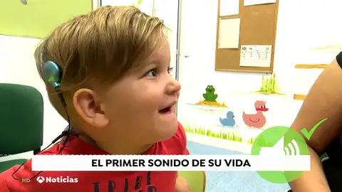 Así reacciona el pequeño Jesús tras escuchar por primera vez con dos años gracias a un implante coclear Así reacciona el pequeño Jesús tras escuchar por primera vez con dos años gracias a un implante coclear