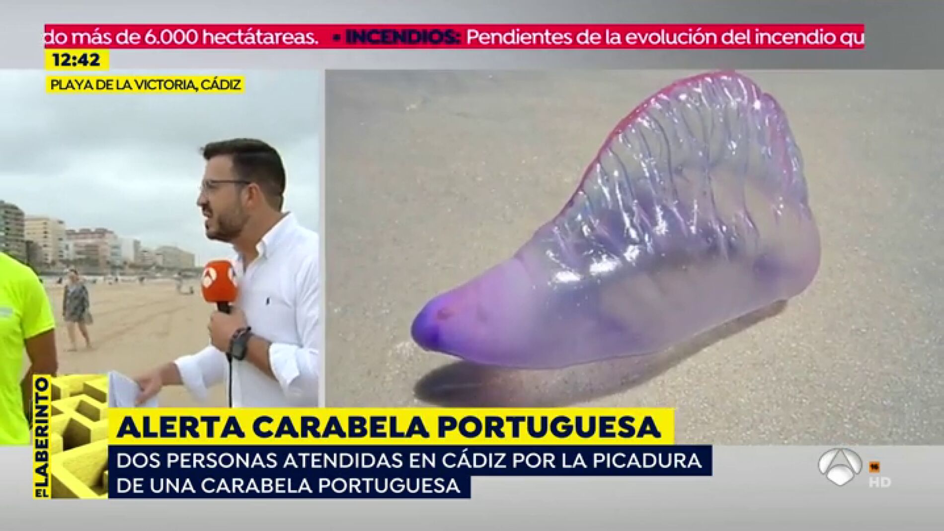 Varios ba&ntilde;istas atendidos por la peligrosa picadura de la Carabela Portuguesa