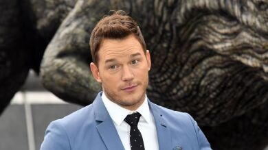 Chris Pratt se desnuda para mostrar sus quemaduras del sol