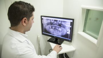 Radiografía de una mandíbula