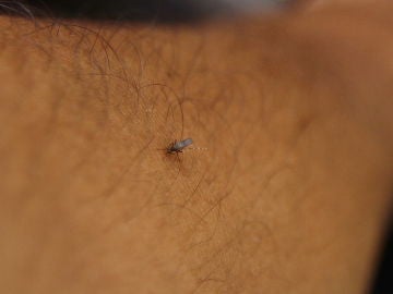 Fotografía tomada de un mosquito en el brazo de una persona