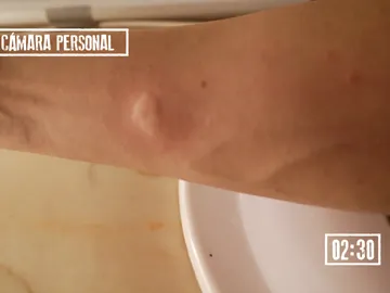 Sergio despierta a sus amigos para buscar un molesto mosquito Sergio despierta a sus amigos para buscar un molesto mosquito