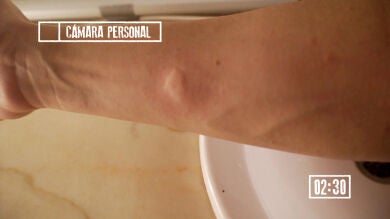 Sergio despierta a sus amigos para buscar un molesto mosquito