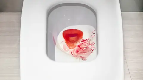 Menstruación Menstruación