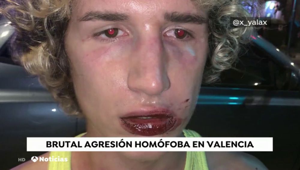 Nueva agresión homófoba a un joven a la salida de una discoteca en Valencia