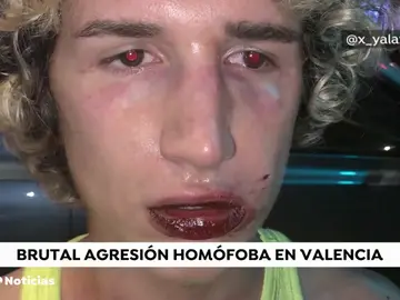 Nueva agresión homófoba a un joven a la salida de una discoteca en Valencia Nueva agresión homófoba a un joven a la salida de una discoteca en Valencia
