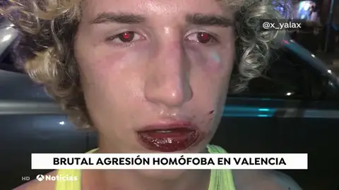Nueva agresión homófoba a un joven a la salida de una discoteca en Valencia Nueva agresión homófoba a un joven a la salida de una discoteca en Valencia