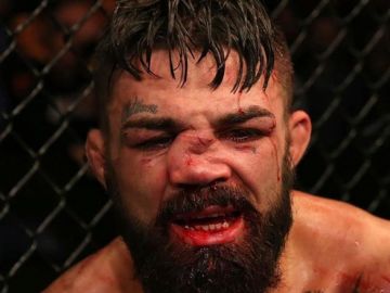 Así quedó la nariz de Mike Perry