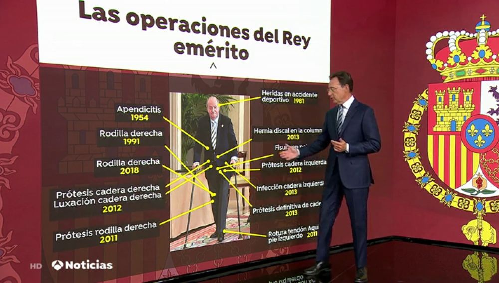 Las 15 operaciones a las que se ha sometido el Rey Juan Carlos