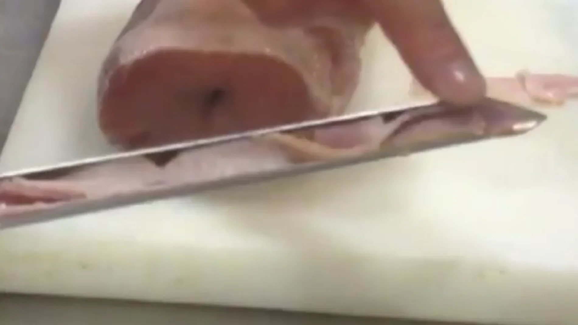 brote de listeriosis brote de listeriosis