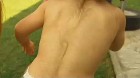 Uno de los bebés afectados por omeprazol defectuoso Uno de los bebés afectados por omeprazol defectuoso