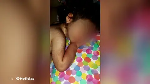 Aumenta a 20 el número de bebés diagnosticados con el 'síndrome del hombre lobo' por el Omeprazol Aumenta a 20 el número de bebés diagnosticados con el 'síndrome del hombre lobo' por el Omeprazol