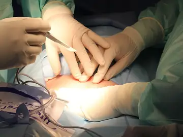 Cirujanos realizando una operación Cirujanos realizando una operación