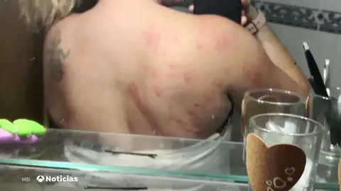 MOSQUITOS MOSQUITOS
