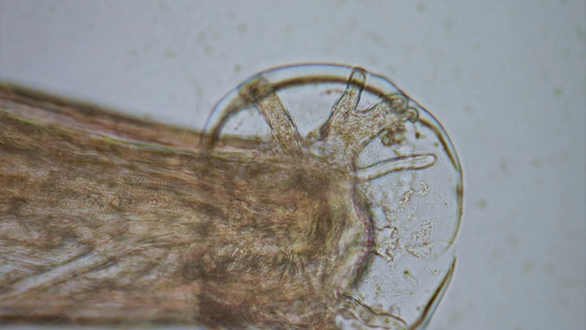 Gusano Angiostrongylus cantonensis Gusano Angiostrongylus cantonensis