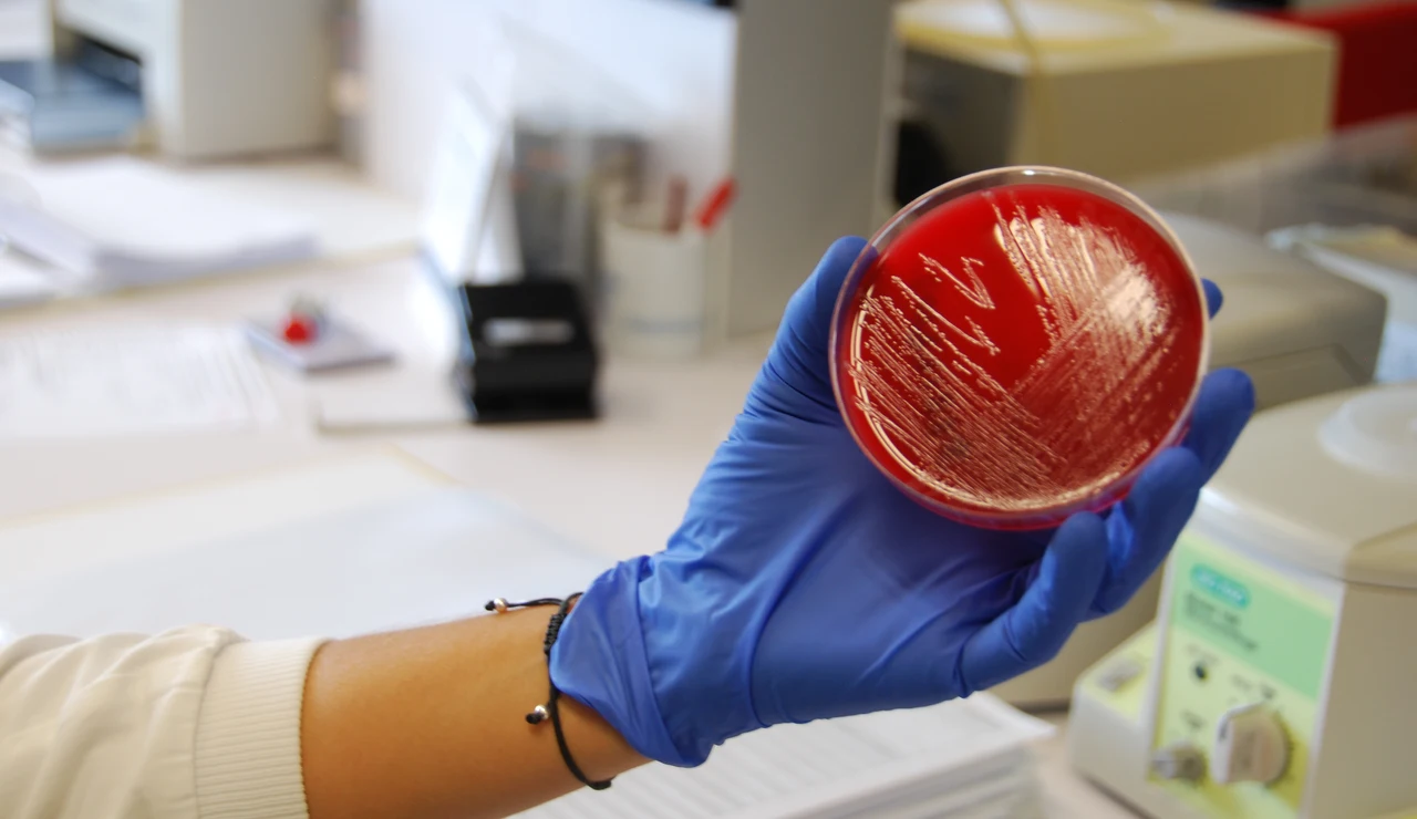 Visitamos los laboratorios que buscan el origen del brote de listeriosis