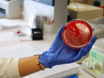 Visitamos los laboratorios que buscan el origen del brote de listeriosis Visitamos los laboratorios que buscan el origen del brote de listeriosis