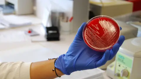 Visitamos los laboratorios que buscan el origen del brote de listeriosis Visitamos los laboratorios que buscan el origen del brote de listeriosis