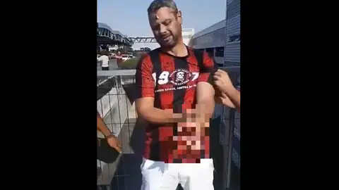 Un hincha pierde la mano Un hincha pierde la mano