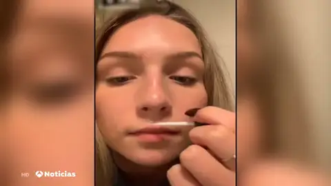 El peligroso nuevo reto viral: pegarse los labios con pegamento para que parezcan más gruesos El peligroso nuevo reto viral: pegarse los labios con pegamento para que parezcan más gruesos