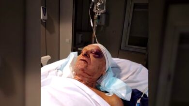 Piden ayuda para localizar a la mujer que atropelló a un anciano en Mallorca