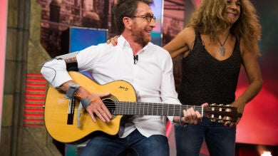 El sexto dedo, el sensacional descubrimiento de Marron en ‘El Hormiguero 3.0’