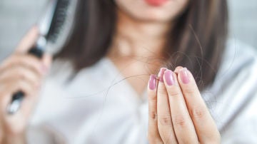 Caída del cabello Caída del cabello