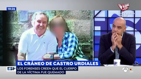 El cráneo de Castro Urdiales. quemado