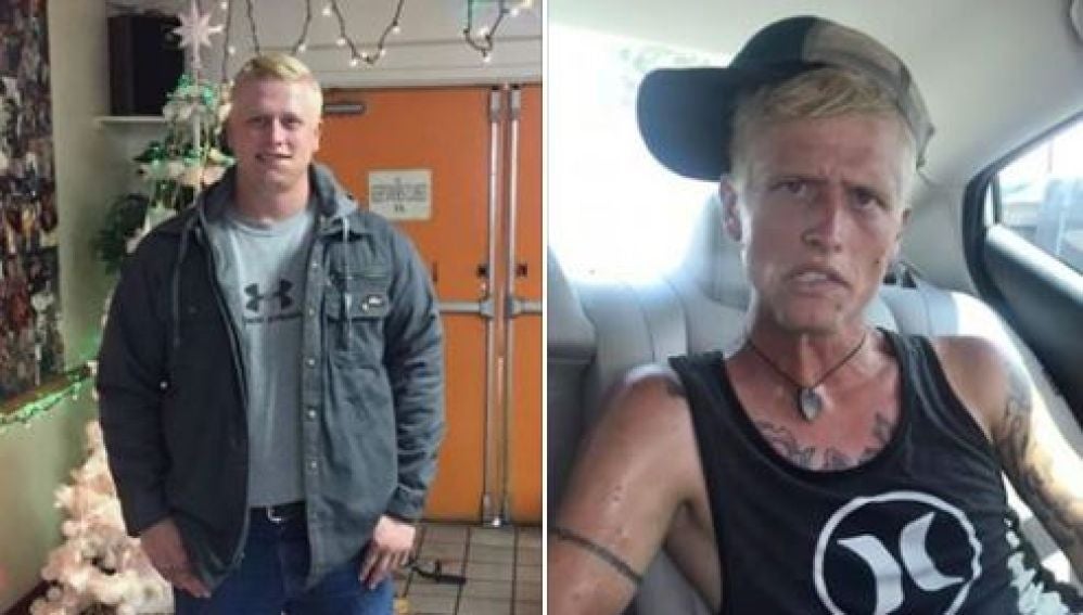 El antes y después de un adicto a las drogas