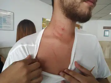 Las heridas del árbitro tras la agresión Las heridas del árbitro tras la agresión