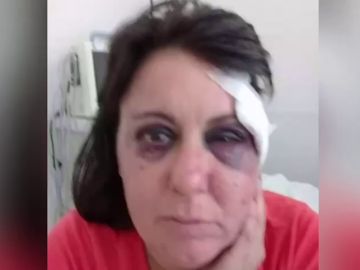 Una mujer denuncia una brutal agresión de un policía en los calabozos: "Te voy a enseñar a respetar, hija de puta"