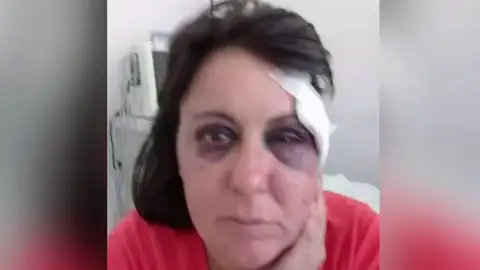Una mujer denuncia una brutal agresión de un policía en los calabozos: "Te voy a enseñar a respetar, hija de puta" Una mujer denuncia una brutal agresión de un policía en los calabozos: "Te voy a enseñar a respetar, hija de puta"