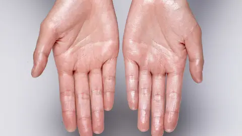 Manos sudadas Manos sudadas