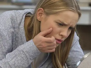 Trucos caseros para acabar con el acné en la adolescencia Trucos caseros para acabar con el acné en la adolescencia