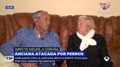 Una anciana de 90 años, a punto de morir tras el ataque de dos perros 'american standford'